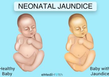 Neonatal Jaundice Could Lead To Permanent Brain Damage If Left Untreated – Paediatric Nurse