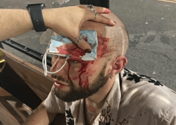 Gay man victim of horrific attack in Liverpool City Centre