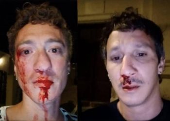 Gay couple beaten by gang of 20 men as dozens stood by and did nothing