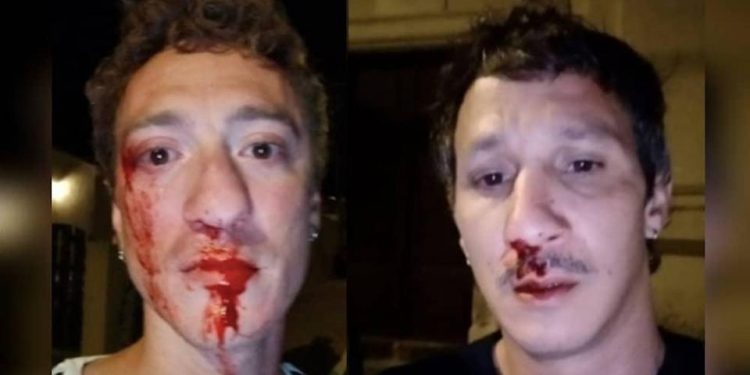 Gay couple beaten by gang of 20 men as dozens stood by and did nothing