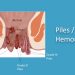 Healthy Diet And A Healthy Lifestyle Reduces The Risk Of Haemorrhoids (Piles) – Doctor Advises