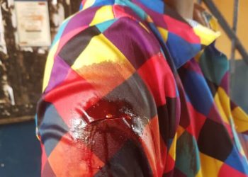 E/R: Man, 23, slashes girlfriend with machete over misunderstanding