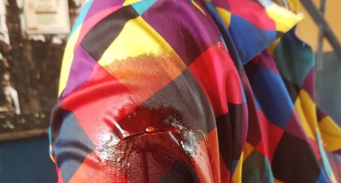 E/R: Man, 23, slashes girlfriend with machete over misunderstanding