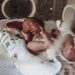 Ghana Losing Babies To Birth Asphyxia