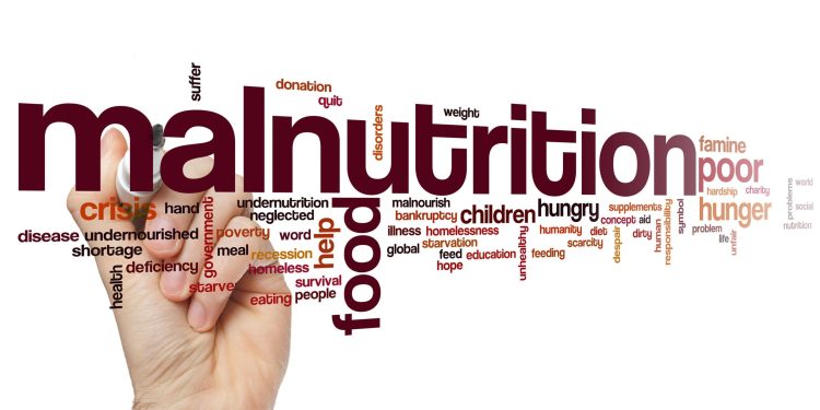 Malnutrition Still A killer Among Children – Nutritionist
