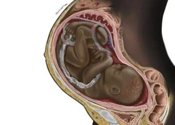Nigerian Student Changes The Game When Illustration Of A Black Woman’s Womb Goes Viral