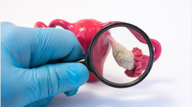 PCOS Disorder Is Very Common In Ghana And It’s About Time Ghanaians Are Given Insight Education On It – Dr Owusu