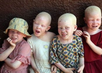 Mozambican Caught ‘Planning Albino Children Sale’