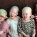 Mozambican Caught ‘Planning Albino Children Sale’