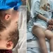 ‘Space-age stuff’: Conjoined Twins Separated With Help Of Virtual Reality In Brazil