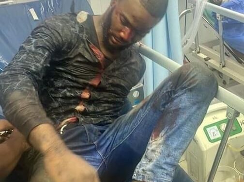 Nigerian Shot After Attacking Guard At Guyana President’s Home