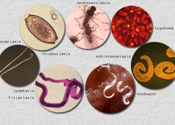 ‘Superstition associated with diseases threatens healthcare delivery’ – Obeng Amoako