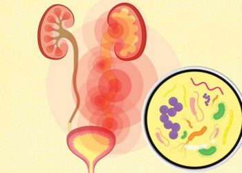 Urinary Tract Infection can be serious if left untreated – Doctor advises