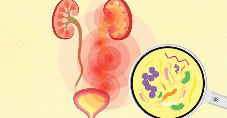 Urinary Tract Infection can be serious if left untreated – Doctor advises