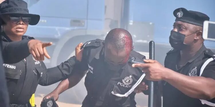 Police Commander, 3 other officers injured by rioting students