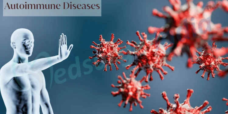 Autoimmune Disease is a silent killer, don’t joke with it – Public advised