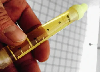 Know your status; Gonorrhea is no respecter of persons – Dr. Amoah