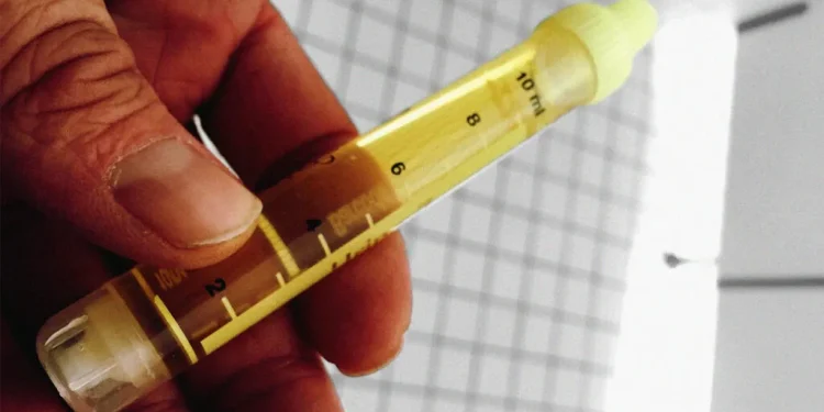 Know your status; Gonorrhea is no respecter of persons – Dr. Amoah