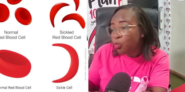 Sickle has no cure but early treatment can relieve pain and help prevent complications-public told