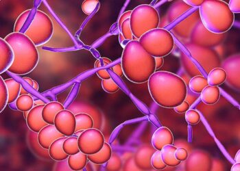 Heat and tight underwear among causes of candidiasis – Microbiologist