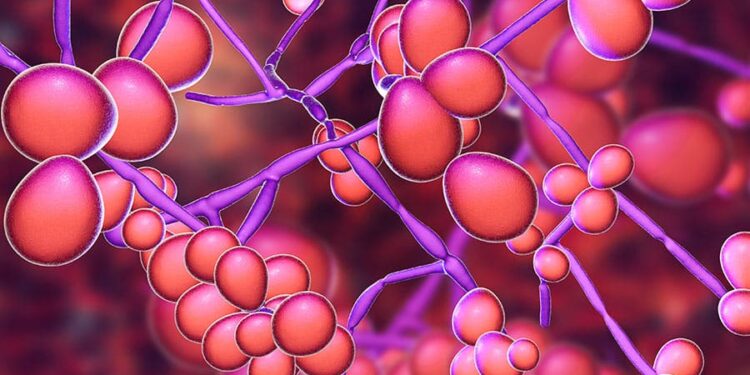 Heat and tight underwear among causes of candidiasis – Microbiologist