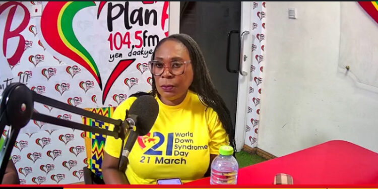 Down Syndrome; Don’t give up on your children – Parents’ advised