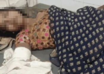 MP Horror: Man chops off wife’s hand with axe, flees with severed bleeding organ; know the shocking reason