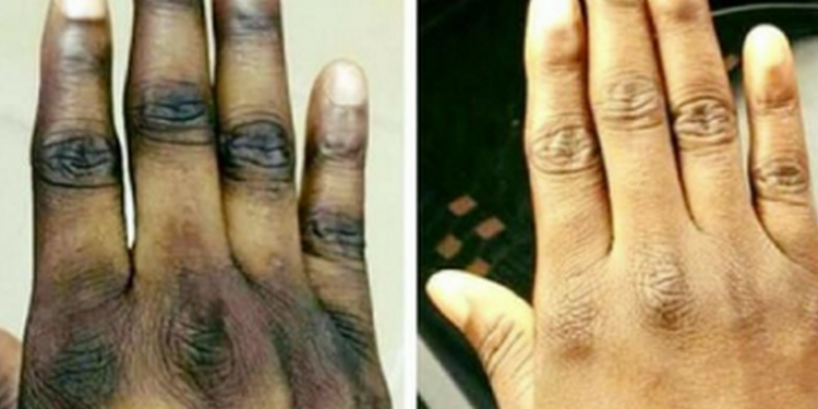 E/R: 30% of students bleaching – Education Director