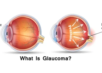 See tomorrow: Don’t let Glaucoma steal your sight – Nursing Officer