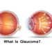 See tomorrow: Don’t let Glaucoma steal your sight – Nursing Officer