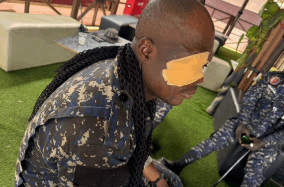 Violence Erupts In Kukurantumi As Suspect’s Death Sparks Clash, Injuring Two Officers