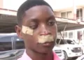 Obrachire SHS student demands justice after brutal assault at inter-schools sports event