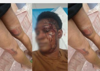 Ghanaian hairdresser attacked, beaten to pulp in her workshop in Johannesburg by suspected xenophobic assailânts