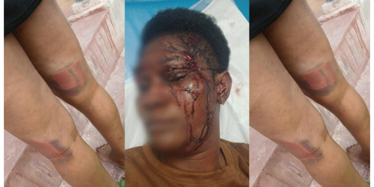 Ghanaian hairdresser attacked, beaten to pulp in her workshop in Johannesburg by suspected xenophobic assailânts
